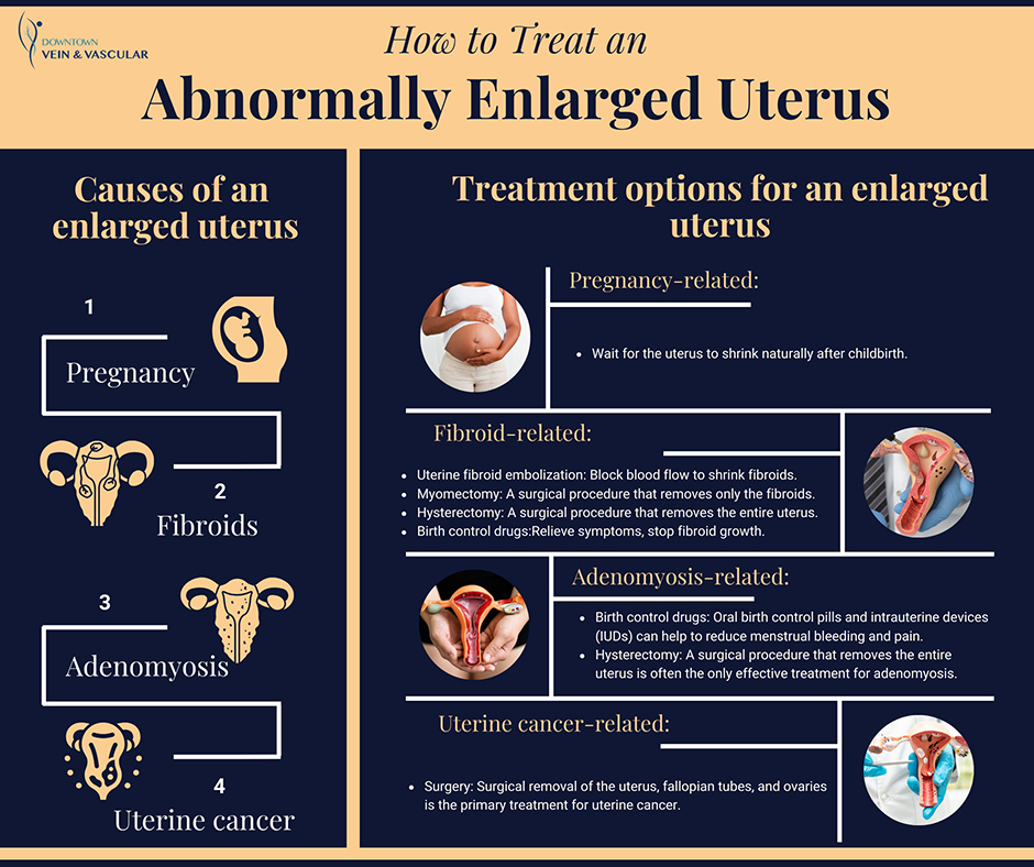 Bulky Uterus: Symptoms, Causes and Treatment