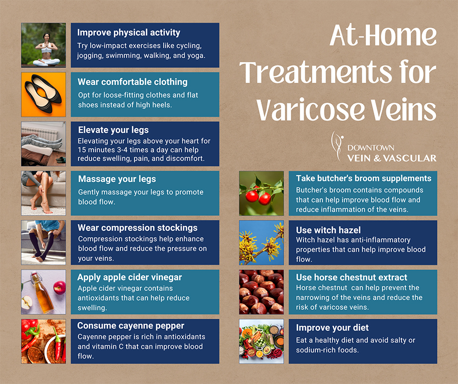 The Best Home Remedies for Varicose Veins - Downtown Vein & Vascular