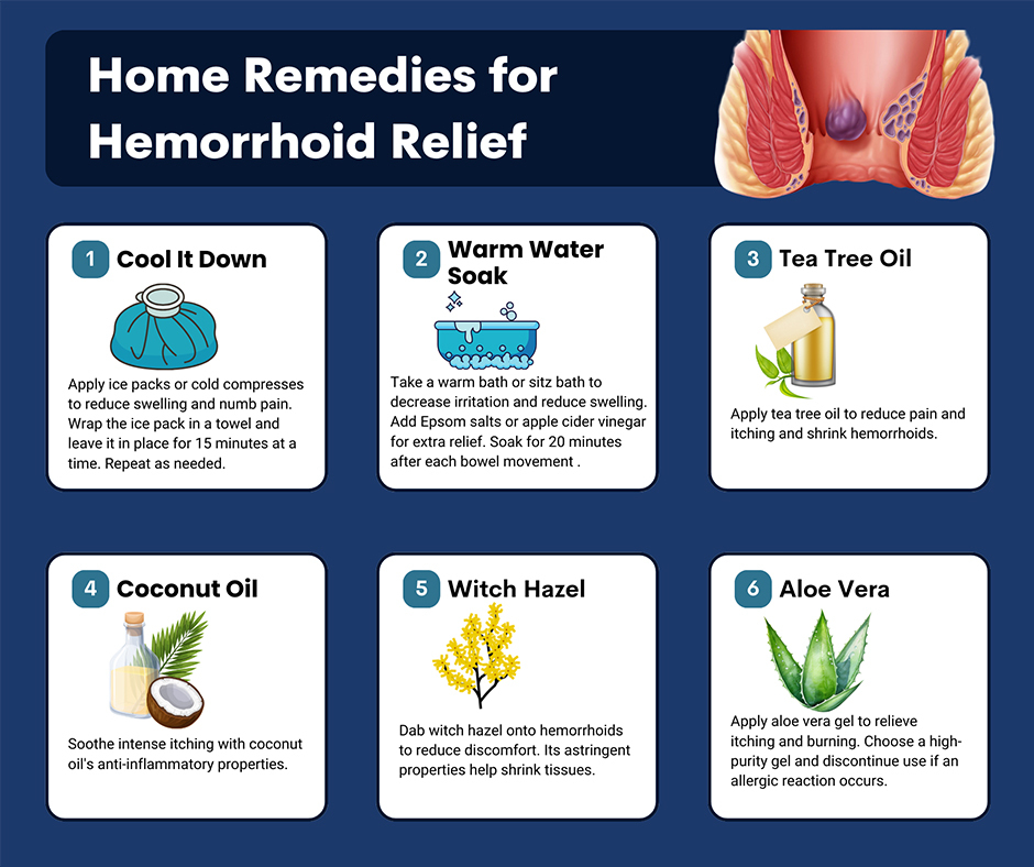 Image result for Beat Hemorrhoids: Top Treatments infographics