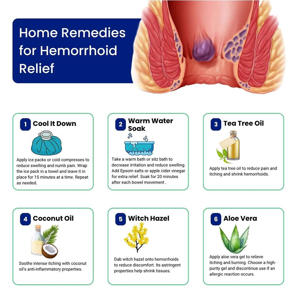Home Remedies For Hemorrhoid Relief