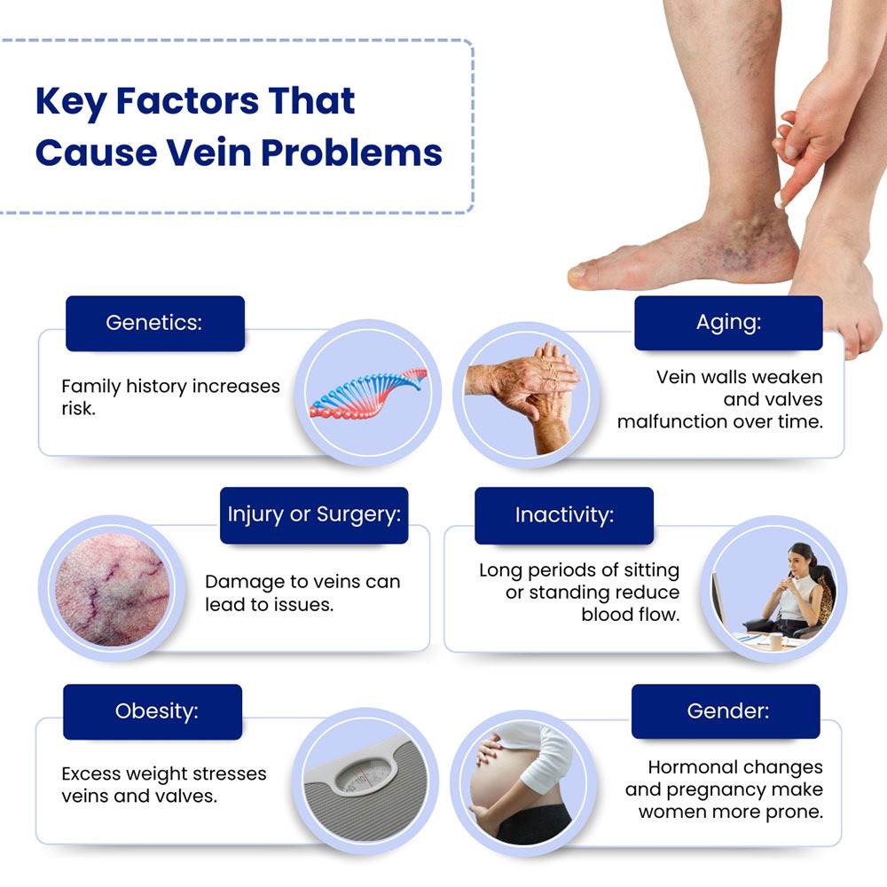 Key Factors That Cause Vein Problems