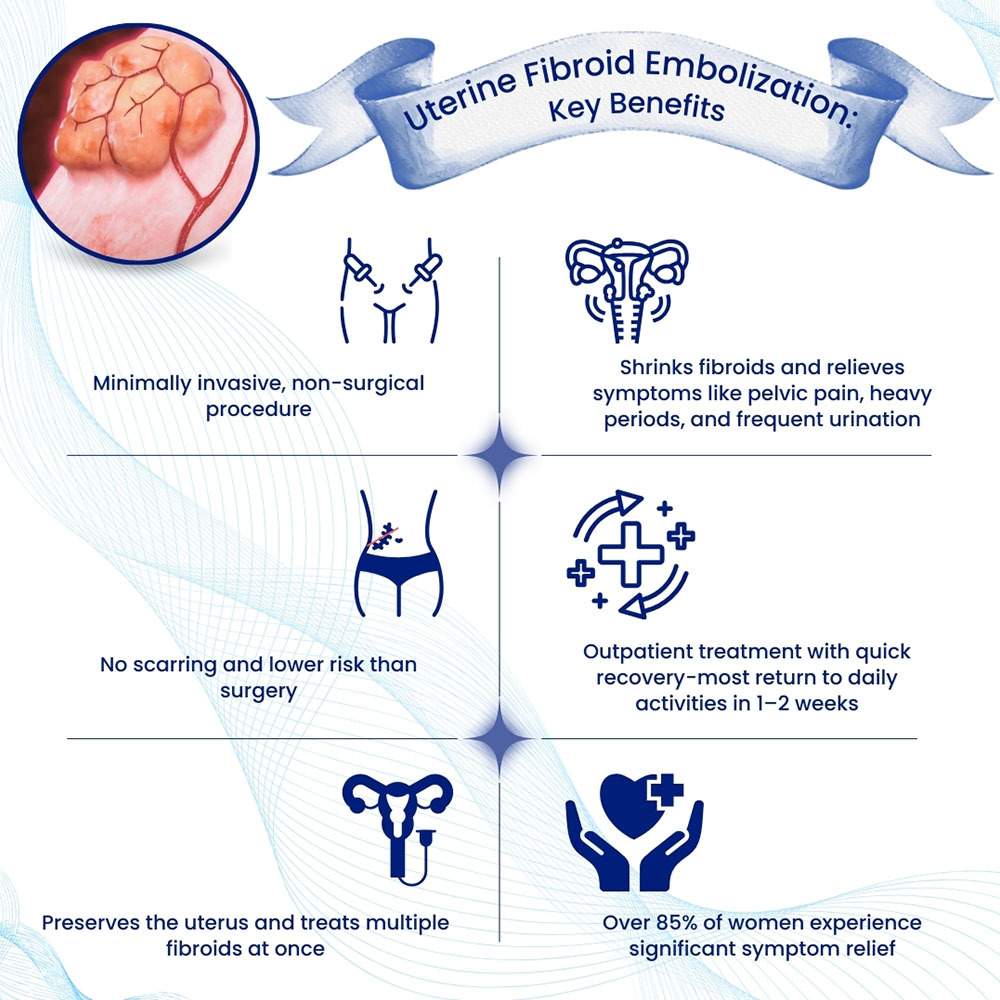 Uterine Fibroid Embolization Key Benefits
